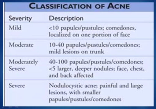Classification of acne